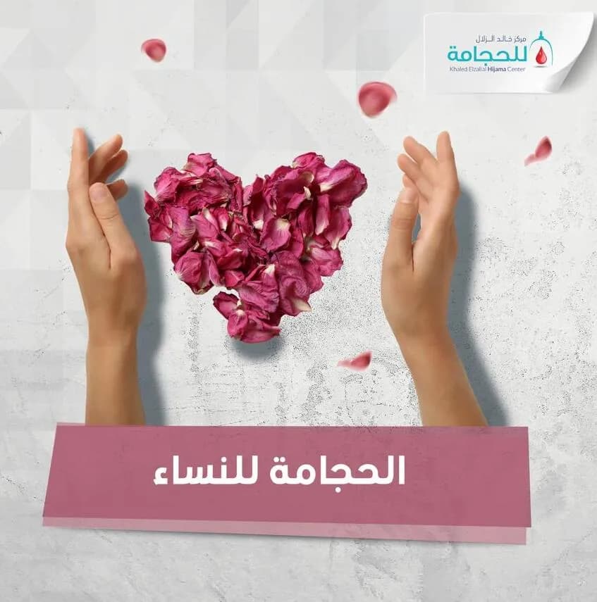 أسئلة شائعة حول الحجامة والدورة الشهرية